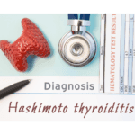 De ziekte van Hashimoto