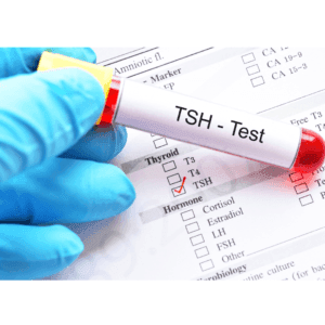 TSH test